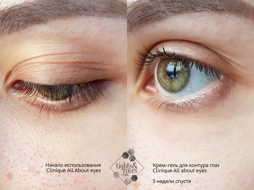 Питательный крем-гель для контура глаз All about eyes от Clinique
